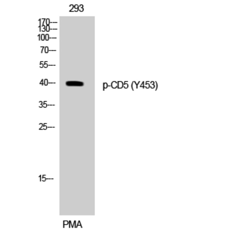 Western Blot - Anti-CD5 (phospho Tyr453) Antibody (A0849) - Antibodies.com