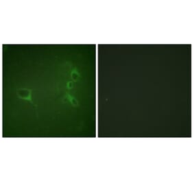 Immunofluorescence - Anti-Bcr (phospho Tyr360) Antibody (A0776) - Antibodies.com