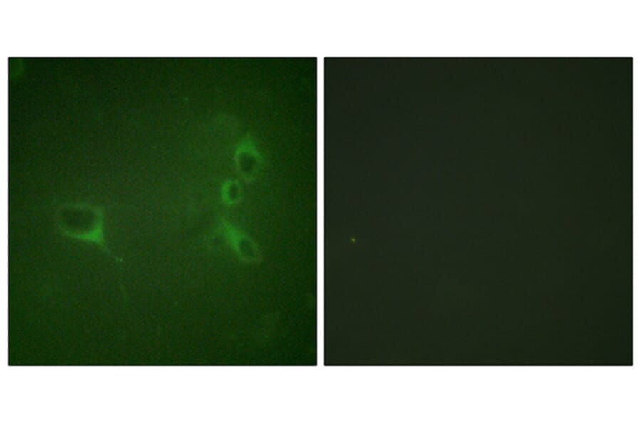 Immunofluorescence - Anti-Bcr (phospho Tyr360) Antibody (A0776) - Antibodies.com