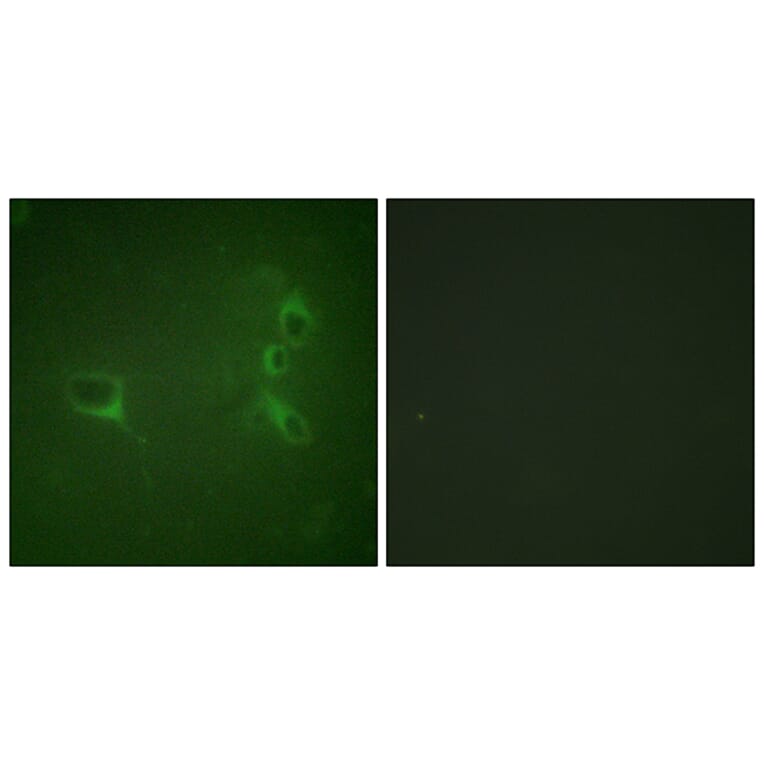 Immunofluorescence - Anti-Bcr (phospho Tyr360) Antibody (A0776) - Antibodies.com