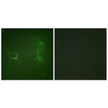 Immunofluorescence - Anti-Bcr (phospho Tyr360) Antibody (A0776) - Antibodies.com