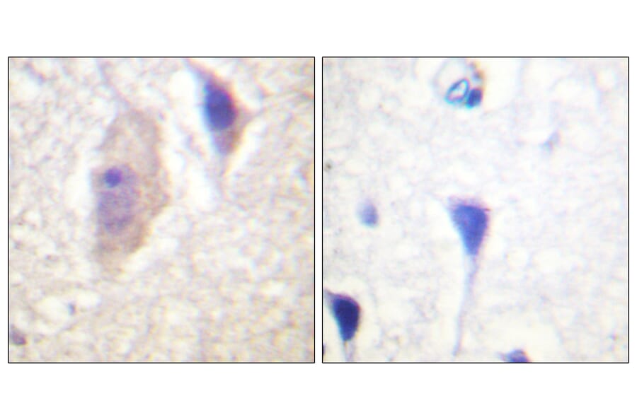 Immunohistochemistry - Anti-Bcr (phospho Tyr360) Antibody (A0776) - Antibodies.com