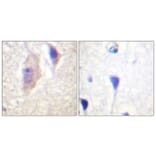 Immunohistochemistry - Anti-Bcr (phospho Tyr360) Antibody (A0776) - Antibodies.com