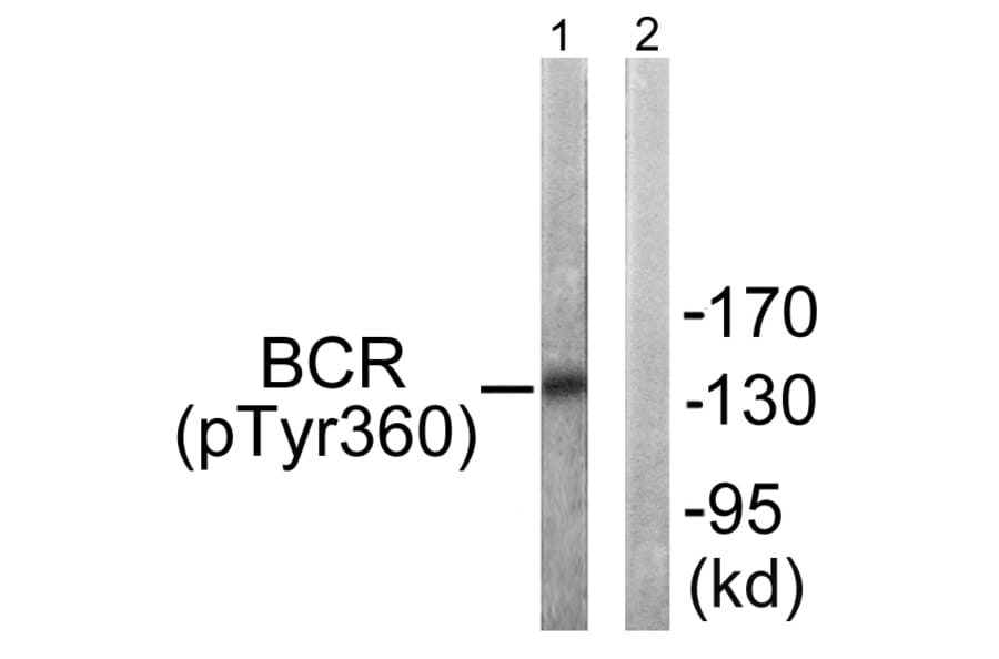 Western Blot - Anti-Bcr (phospho Tyr360) Antibody (A0776) - Antibodies.com