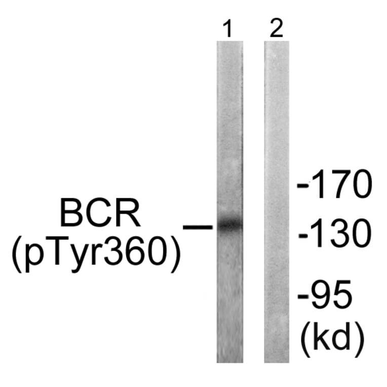 Western Blot - Anti-Bcr (phospho Tyr360) Antibody (A0776) - Antibodies.com