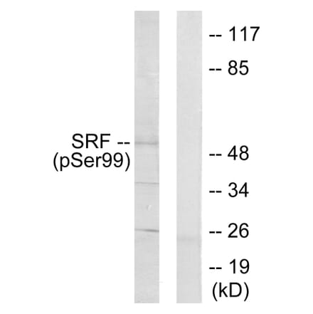 Western Blot - Anti-SRF (phospho Ser99) Antibody (A0088) - Antibodies.com