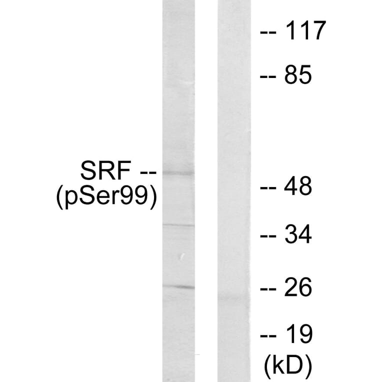 Western Blot - Anti-SRF (phospho Ser99) Antibody (A0088) - Antibodies.com