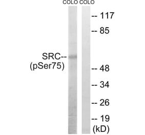Western Blot - Anti-Src (phospho Ser75) Antibody (A8186) - Antibodies.com