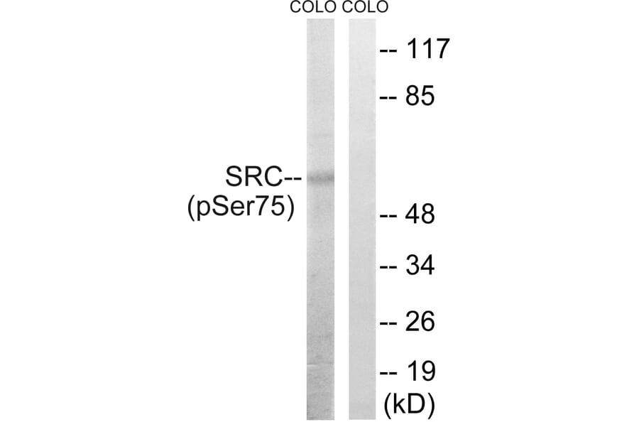 Western Blot - Anti-Src (phospho Ser75) Antibody (A8186) - Antibodies.com