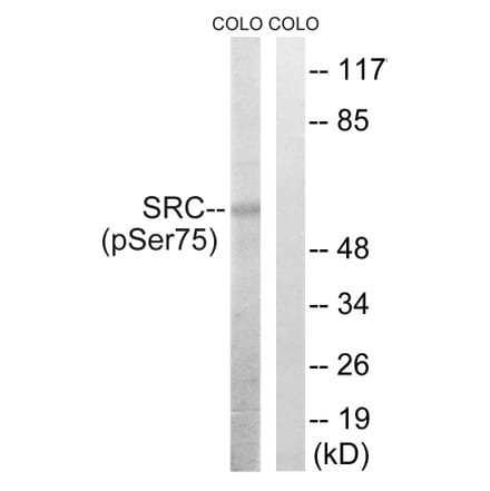 Western Blot - Anti-Src (phospho Ser75) Antibody (A8186) - Antibodies.com