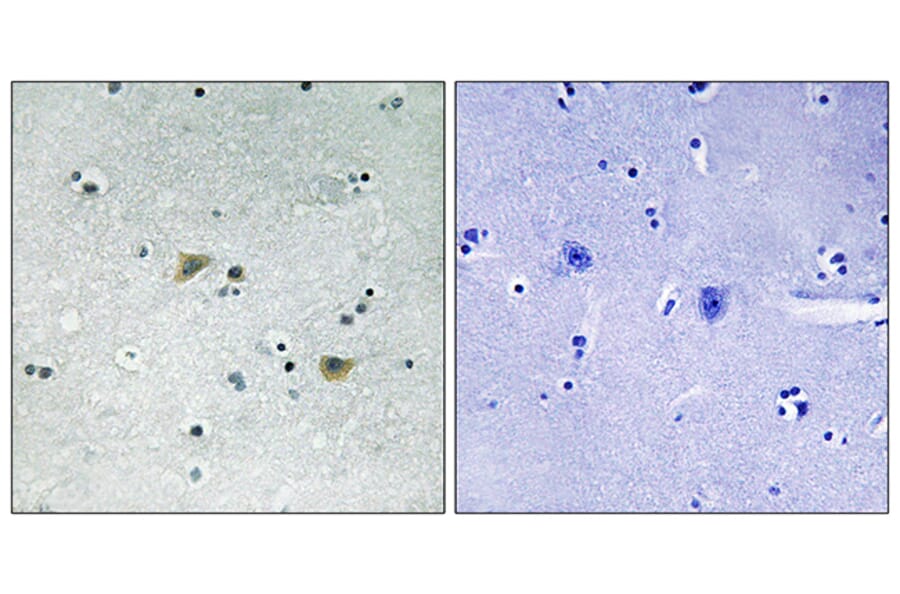Immunohistochemistry - Anti-Src (phospho Ser75) Antibody (A8186) - Antibodies.com