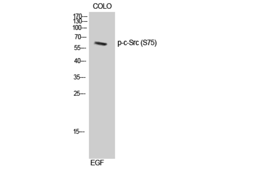 Western Blot - Anti-Src (phospho Ser75) Antibody (A8186) - Antibodies.com