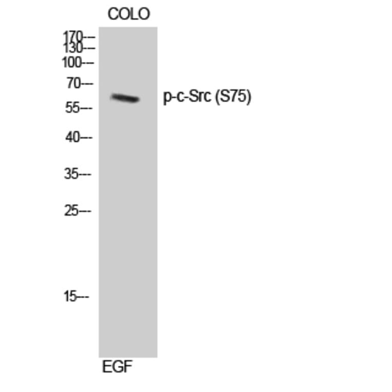 Western Blot - Anti-Src (phospho Ser75) Antibody (A8186) - Antibodies.com