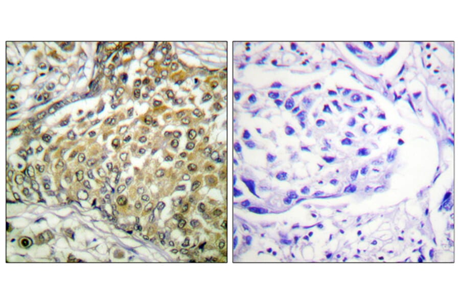 Immunohistochemistry - Anti-p53 (acetyl Lys379) Antibody (D0016) - Antibodies.com