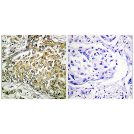 Immunohistochemistry - Anti-p53 (acetyl Lys379) Antibody (D0016) - Antibodies.com