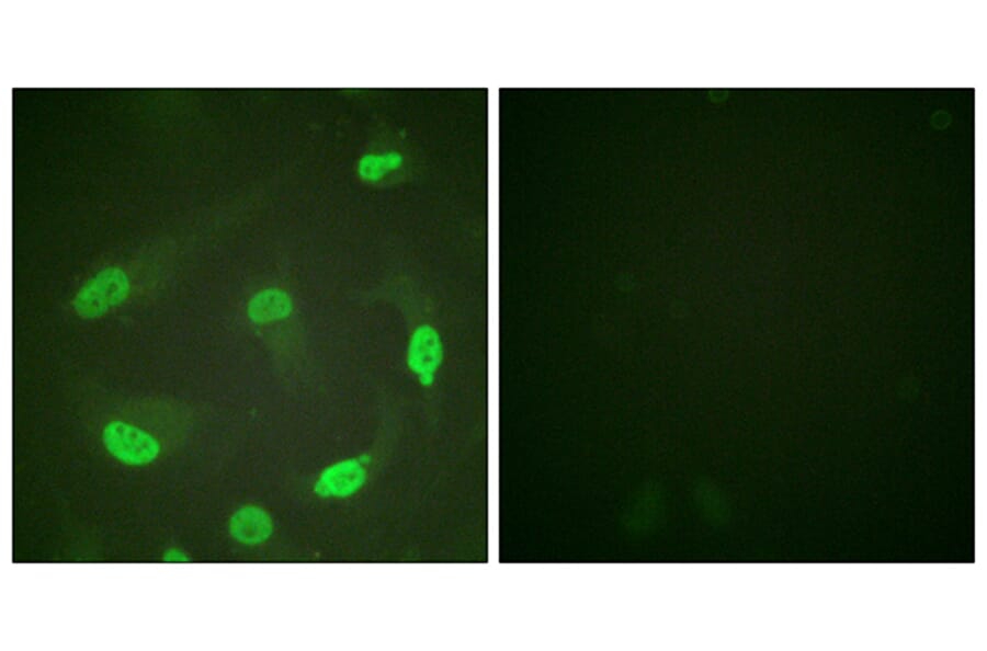 Immunofluorescence - Anti-p53 (acetyl Lys379) Antibody (D0016) - Antibodies.com