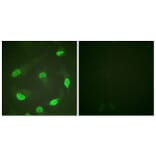 Immunofluorescence - Anti-p53 (acetyl Lys379) Antibody (D0016) - Antibodies.com
