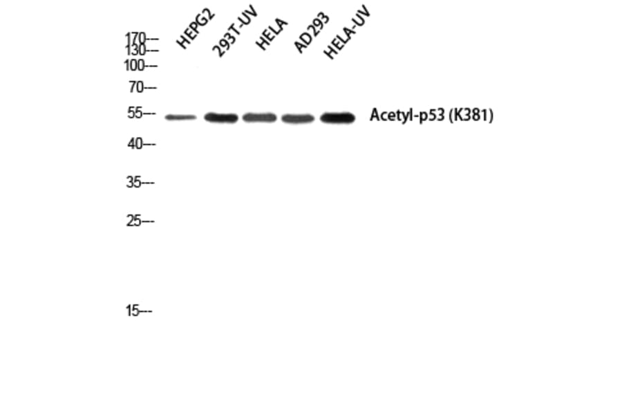 Western Blot - Anti-p53 (acetyl Lys379) Antibody (D0016) - Antibodies.com