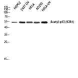 Western Blot - Anti-p53 (acetyl Lys379) Antibody (D0016) - Antibodies.com