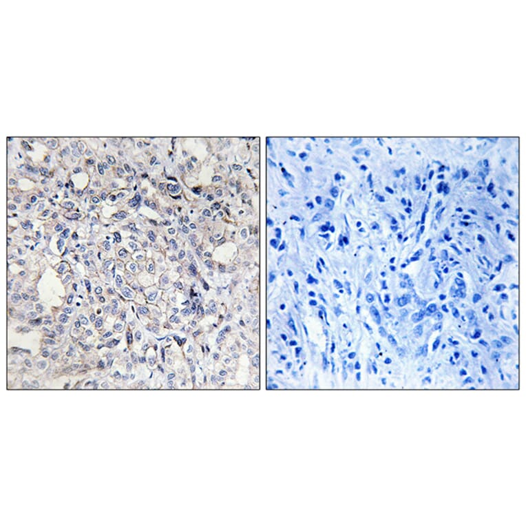 Immunohistochemistry - Anti-Heparin Cofactor II Antibody (C10281) - Antibodies.com