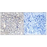 Immunohistochemistry - Anti-Heparin Cofactor II Antibody (C10281) - Antibodies.com