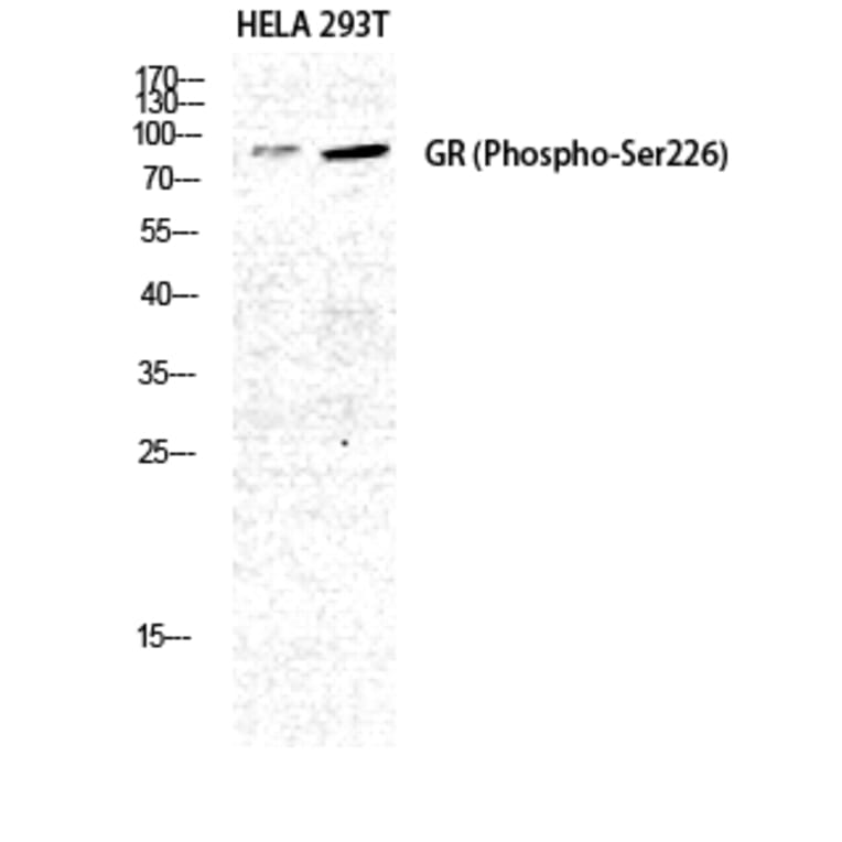 Western Blot - Anti-GR (phospho Ser226) Antibody (A0432) - Antibodies.com
