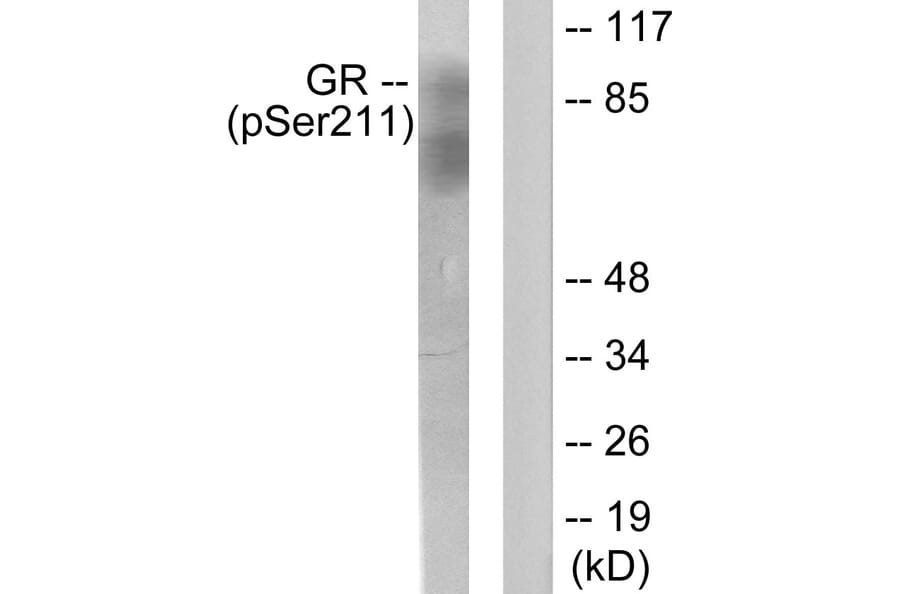 Western Blot - Anti-GR (phospho Ser211) Antibody (A0073) - Antibodies.com