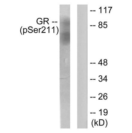Western Blot - Anti-GR (phospho Ser211) Antibody (A0073) - Antibodies.com