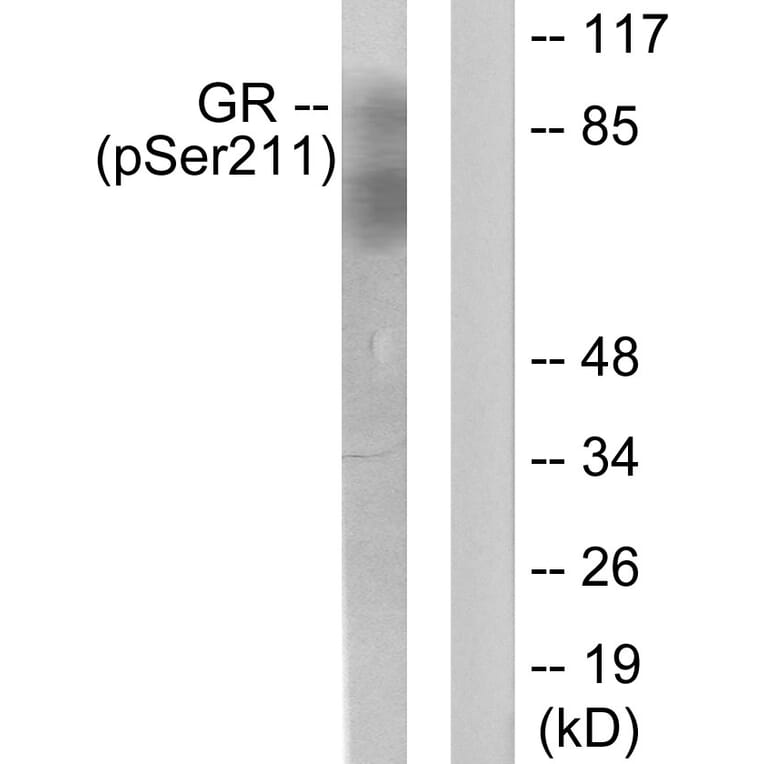 Western Blot - Anti-GR (phospho Ser211) Antibody (A0073) - Antibodies.com