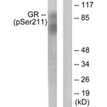 Western Blot - Anti-GR (phospho Ser211) Antibody (A0073) - Antibodies.com