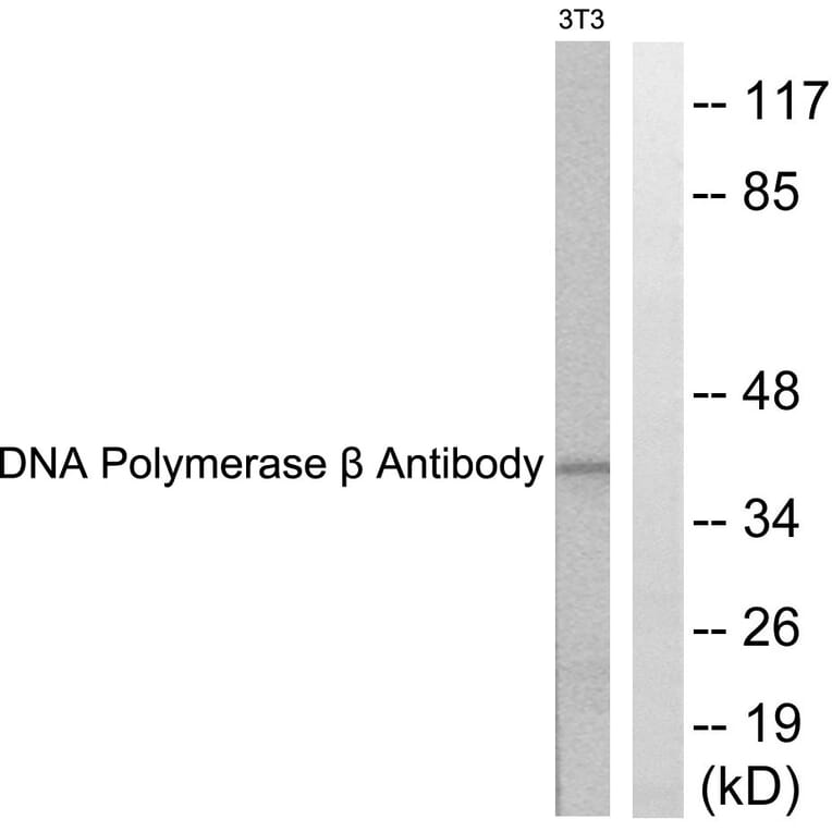 Western Blot - Anti-DNA Polymerase beta Antibody (C0173) - Antibodies.com