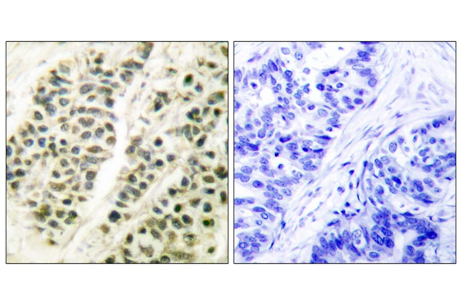 Immunohistochemistry - Anti-DNA Polymerase beta Antibody (C0173) - Antibodies.com