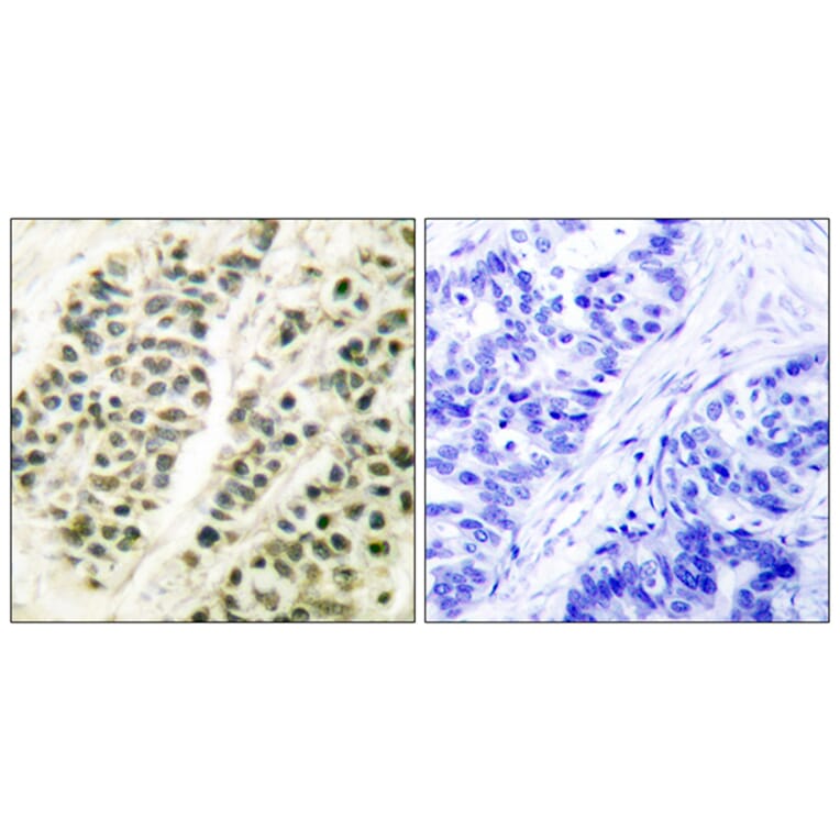 Immunohistochemistry - Anti-DNA Polymerase beta Antibody (C0173) - Antibodies.com