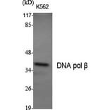 Western Blot - Anti-DNA Polymerase beta Antibody (C0173) - Antibodies.com
