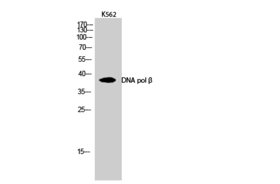 Western Blot - Anti-DNA Polymerase beta Antibody (C0173) - Antibodies.com