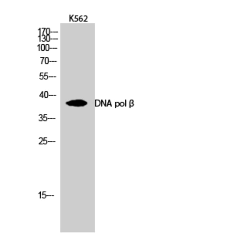 Western Blot - Anti-DNA Polymerase beta Antibody (C0173) - Antibodies.com