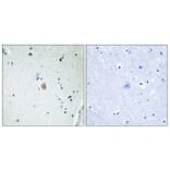 Immunohistochemistry - Anti-Cytochrome P450 2E1 Antibody (C12267) - Antibodies.com