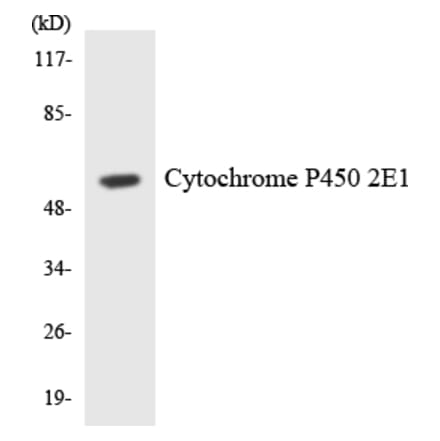 Western Blot - Anti-Cytochrome P450 2E1 Antibody (R12-2679) - Antibodies.com