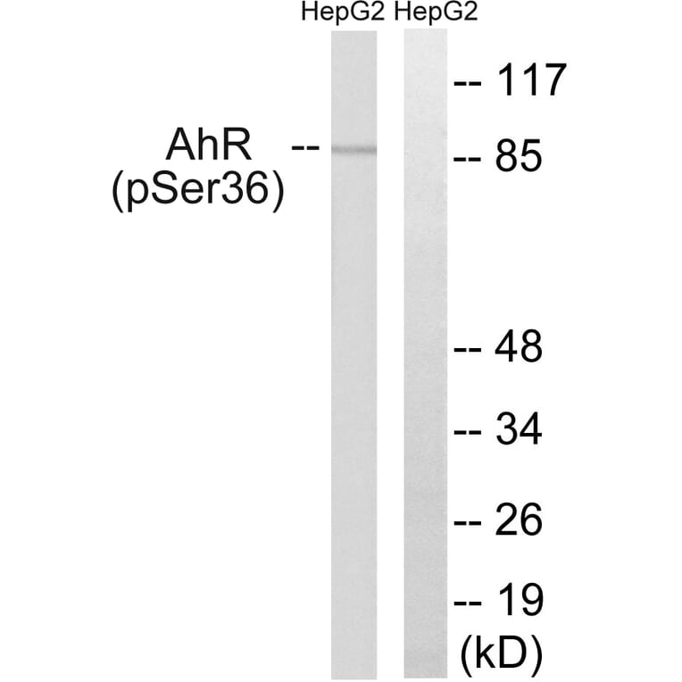 Western Blot - Anti-AhR (phospho Ser36) Antibody (A0765) - Antibodies.com