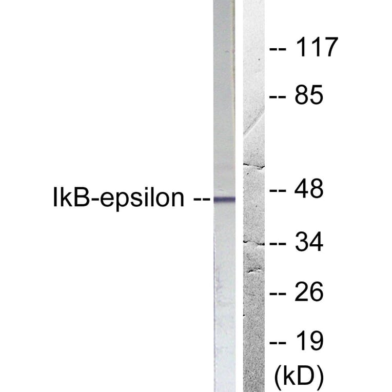 Western Blot - Anti-IkappaB-epsilon Antibody (B0015) - Antibodies.com