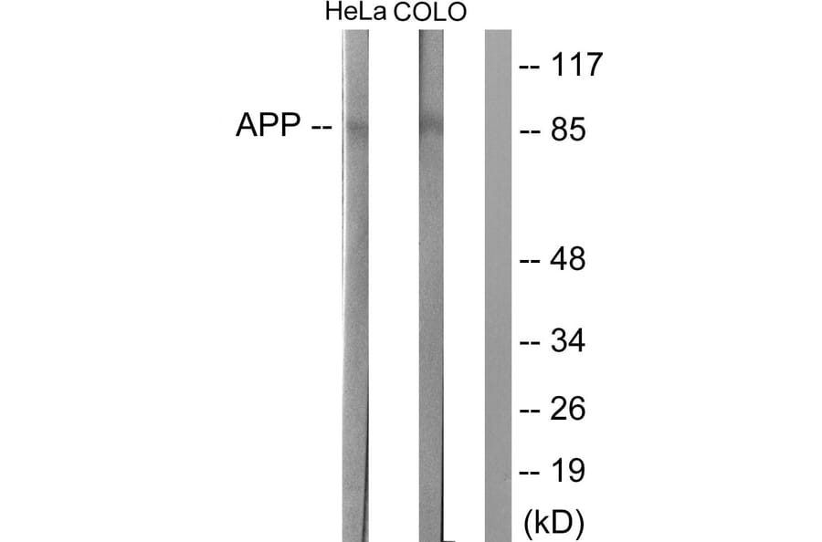 Western Blot - Anti-Amyloid beta A4 Antibody (B0004) - Antibodies.com