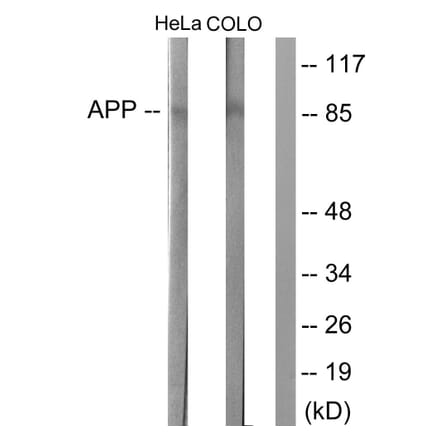 Western Blot - Anti-Amyloid beta A4 Antibody (B0004) - Antibodies.com