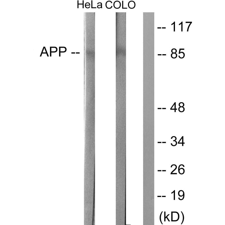 Western Blot - Anti-Amyloid beta A4 Antibody (B0004) - Antibodies.com