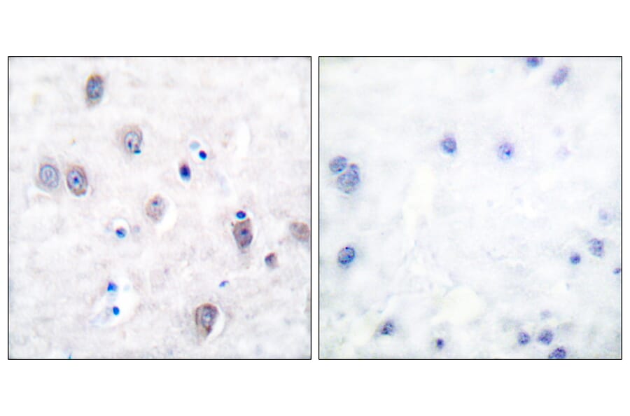 Immunohistochemistry - Anti-Amyloid beta A4 Antibody (B0004) - Antibodies.com