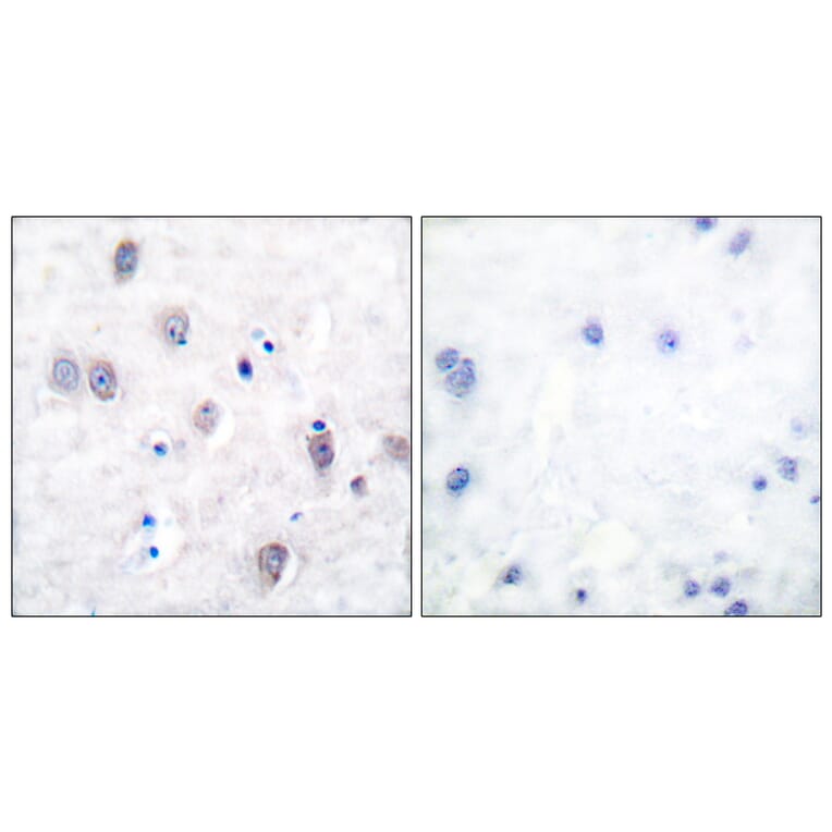 Immunohistochemistry - Anti-Amyloid beta A4 Antibody (B0004) - Antibodies.com