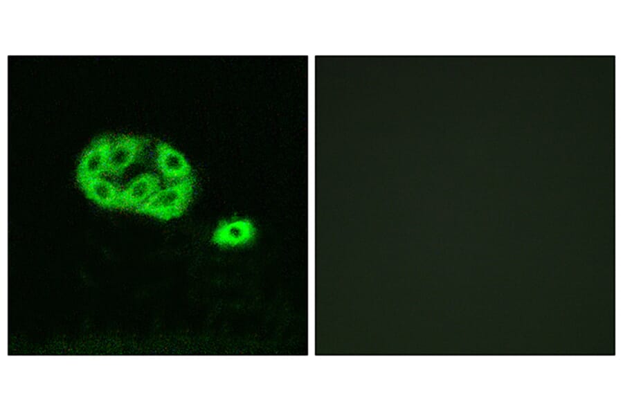 Immunofluorescence - Anti-PI 3 Kinase p85 alpha + Gamma (phospho Tyr467 + Tyr199) Antibody (A1224) - Antibodies.com