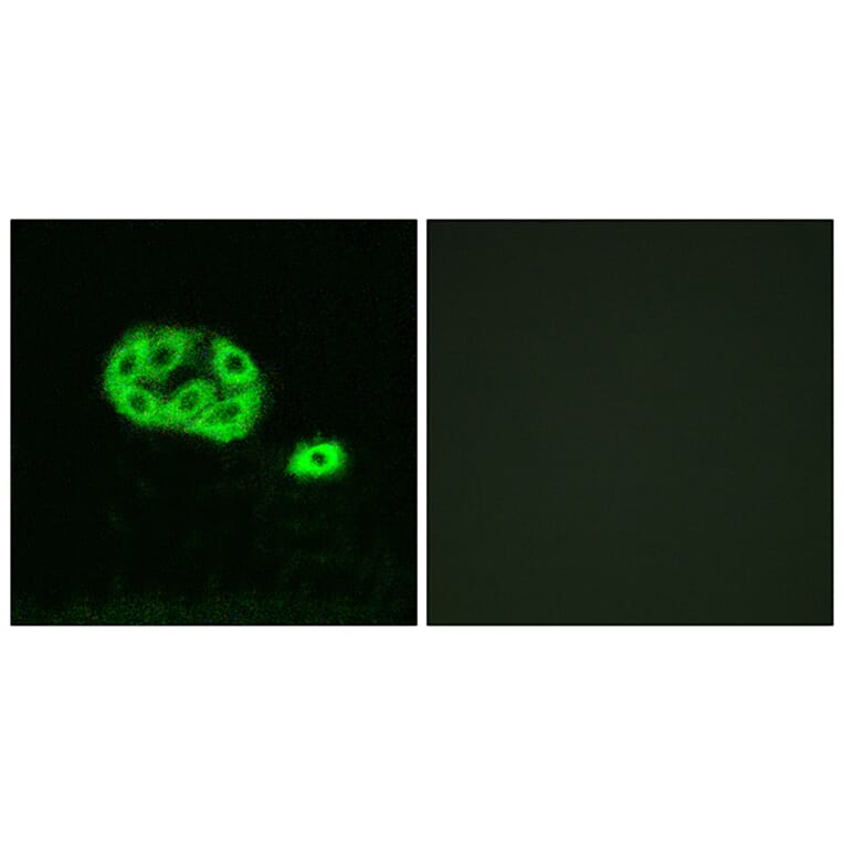 Immunofluorescence - Anti-PI 3 Kinase p85 alpha + Gamma (phospho Tyr467 + Tyr199) Antibody (A1224) - Antibodies.com
