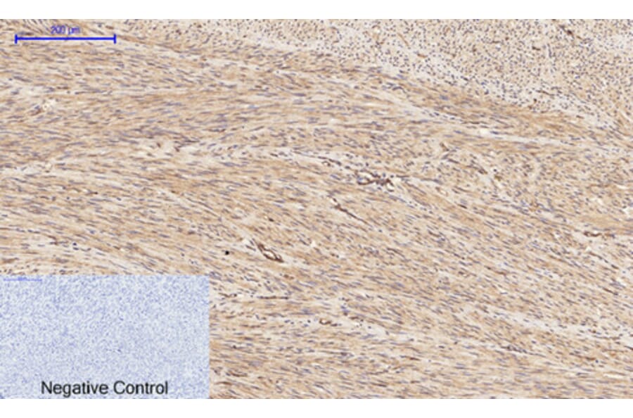Immunohistochemistry - Anti-PI 3 Kinase p85 alpha + Gamma (phospho Tyr467 + Tyr199) Antibody (A1224) - Antibodies.com