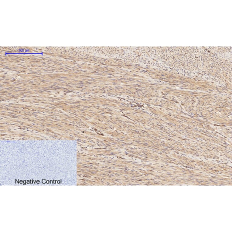 Immunohistochemistry - Anti-PI 3 Kinase p85 alpha + Gamma (phospho Tyr467 + Tyr199) Antibody (A1224) - Antibodies.com