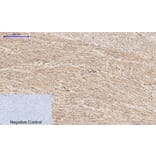 Immunohistochemistry - Anti-PI 3 Kinase p85 alpha + Gamma (phospho Tyr467 + Tyr199) Antibody (A1224) - Antibodies.com